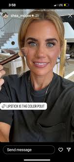 Blepharoplasty : r/UtahInfluencerDrama