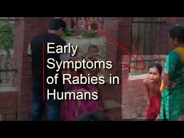 Once the disease progresses, though, it is nearly always fatal. Early Symptoms Of Rabies In Humans Youtube