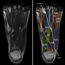 General anatomy and the musculoskeletal system: Magnetic Resonance Imaging Mri Image Showing Foot Muscles And Download Scientific Diagram