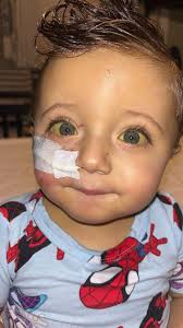 What to expect while waiting for a liver transplant?