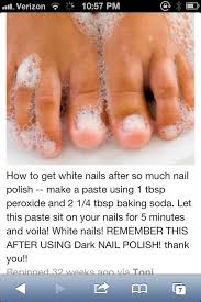 Pin By Hannah Loveless On Hair White Toenails Beauty Hacks Health And Beauty Tips