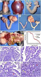 Doctors call these tumour markers. High Grade Serous Ovarian Cancer Arises From Fallopian Tube In A Mouse Model Pnas