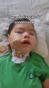 Fixador De Sonda Naso Enteral Infantil