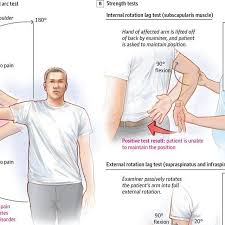 Image result for Shoulder Strength Exam
