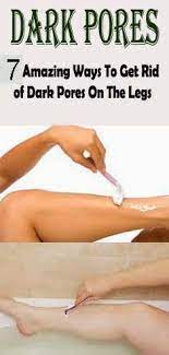 7 Amazing Ways To Get Rid Of Dark Pores On Legs Fashion Mag Dark Pores Health And Beauty Tips Beauty Remedies