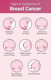Breast cancer affects approximately one in eight women in their lifetime. 8 Early Signs Of Breast Cancer Doctors Want You To Know About