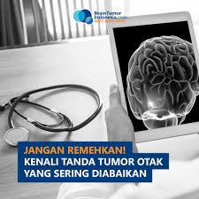 Oleh karena itu memahami tanda dan gejala tumor otak sedini mungkin menjadi penting. Brain Tumor Indonesia Home Facebook
