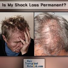 Shock loss is a common occurrence that happens after a hair transplant. Is My Shock Loss From My Hair Transplant Permanent Low Level Laser Therapy Hair Transplant Lost Hair