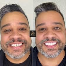 Sorrisos e Sonrisitas. (@sorrisosesonrisitas) · Instagram 照片和视频