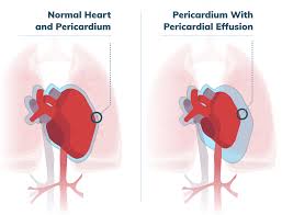 Image result for Pericardium