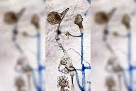 The condition, known as mucormycosis, seems to be infecting some covid patients with weakened immune systems and underlying conditions, particularly diabetes. Jr1sjgoitv3w7m