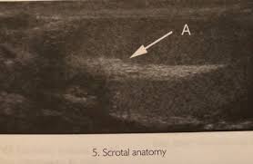 More than 50 million students study for free using the quizlet app each month. Dms 221 The Scrotum Flashcards Quizlet