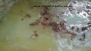 يختلف لون دم الدورة الشهرية عن دم الحمل إذ يكون لون دم الحيض أحمر، بينما يكون لون دم الحمل بنياً أو أحمر داكن أو وردياً. Ø§Ø¹Ø±Ø§Ø¶ Ù…Ù† Ø´Ø±Ø¨ Ø¯Ù… Ø§Ù„Ø­ÙŠØ¶ Farizmedia Com