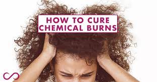 Usually, a person's scalp that is unhealthy, which has dandruff or has become sensitive due to continued exposure to chemicals, is most at risk. Chemical Burn Treatment How To Treat Chemical Burns Hairfinity