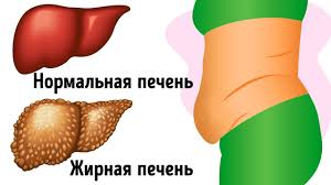 10 Trevozhnyh Signalov O Tom Chto V Pecheni Polno Toksinov Youtube