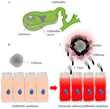 Enterica is the type species and is further divided into six subspecies that include over 2. Ijms Free Full Text Biofilm Producing Salmonella Typhi Chronic Colonization And Development Of Gallbladder Cancer