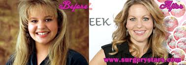 Being a child, candace used to look slightly bigger sized. Candace Cameron Plastic Surgery Before And After Pictures