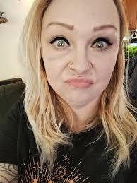 Devastated at the state of my kneecap Alison E Killick