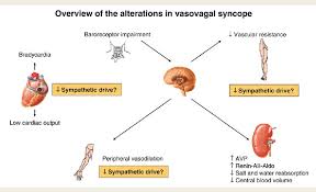 Incidence varies by gender, women are at greater risk. Figure 1 From Vasovagal Syncope Sympathetic Mechanisms And Prognosis The Shape Of Things To Come Semantic Scholar