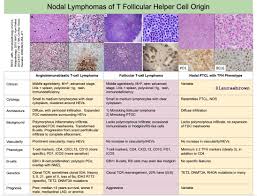 Intensive chemo using several drugs is. Nodal Lymphomas Of T Follicular Helper Cell Origin Grepmed