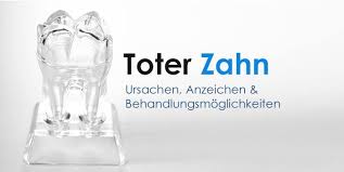 Wann ist eine entfernung der weißheitszähne notwendig und wie funktioniert sie? Wie Ein Toter Zahn Entsteht Und Wie Sie Ihn Behandeln Konnen Dentalwissen