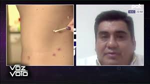 El jefe de Epidemiología Dorian Jiménez