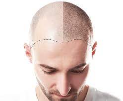 Botox and fillers, dermal fillers . Stem Medical Aesthetics Be You Renewed Restored Rejuvenated
