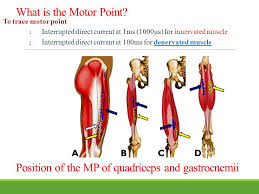 Neuromuscular Electrical Stimulation Nmes Ppt Video