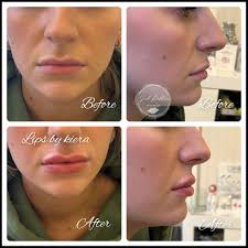 Good Riddance Aesthetics