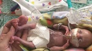 Aborto Em Recife A Barbarie E Bocalidade Nao Salvam Nenhuma Crianca