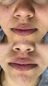 ✨ A famosa depilação egípcia com linha remove até os pelos mais fininhos do  buço com precisão e delicadeza., Menos irritação, pele lisinha e acabamento  perfeito!, Já experimentou? Vem sentir a ...