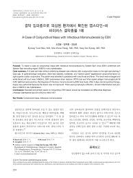 약물은 다음과 같은 헤르페스 바이러스에 대한 가장 효과적이다 : Pdf A Case Of Conjunctival Mass With Infectious Mononucleosis By Ebv