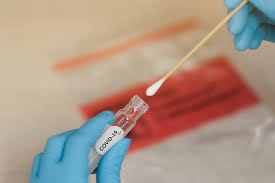 Covid 19 Antibody Testing Instant Urgent Care