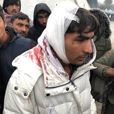 Croatia, officially the republic of croatia (croatian: Croatia Abuses Migrants While The Eu Turns A Blind Eye