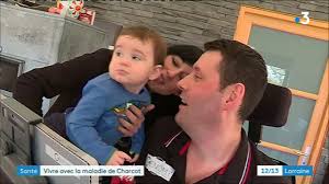 Elle peut survenir dès l'âge de 40 ans, chez. Vivre Avec La Maladie De Charcot Youtube