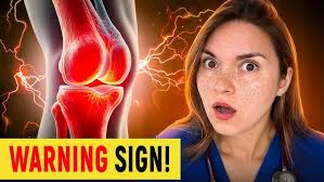 DonJoy Reaction Knee Brace