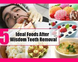 The best thing you can do the day of your procedure is to go home and rest after your visit. 7 Best Foods To Eat After Tooth Extraction Which You Don T Know Included Peanut Butter Wisdom Teeth Removal Food Food After Wisdom Teeth Wisdom Teeth Food