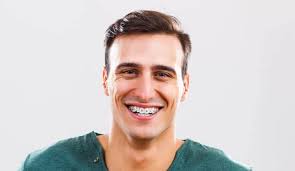 Luckily, there are a few different options available to correct gaps between teeth. I Still Have A Gap In My Teeth After 3 Years Of Braces Ask The Dentist