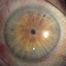 Image result for Pupil