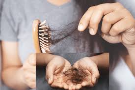 It is thought to be extracted from the dark fruits of the saw palmetto tree and helps reduce hereditary hair loss. Saw Palmetto For Hair Can It Stop Hair Loss Roncuvita
