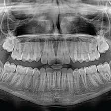 Do You Ever Wonder What We Use Dental X Rays For Watch This Video To Find Out Why X Rays Are Such A Valuable Resource For Maki Dentist Day Dental Facts Dental
