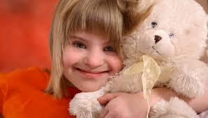 Image result for turner syndrome symptoms pictures
