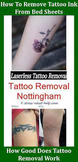 Do You Need Bandages For Laser Tattoo Removal Hypopigmentation From Tattoo Removal Does Tattoo Removal Tattoo Removal Cost Tattoo Removal Laser Tattoo Removal