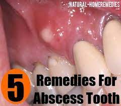 Pin On Home Remedies