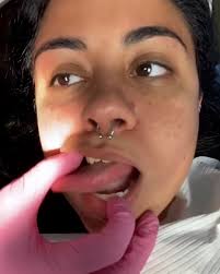 When your best friend is a dental assistant