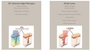 Laser hair removal prices at la beauty skin center. Sliq Clinic Alma Laser Hair Removal Review Fishmeatdie