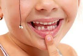 These primary or baby teeth will remain for only a short period; 6 Ways To Remove Loose Baby Tooth Without Pain At Home