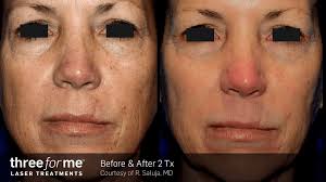 Beverly Grove Los Angeles, CA: Miracle Mile Aesthetics & ENT