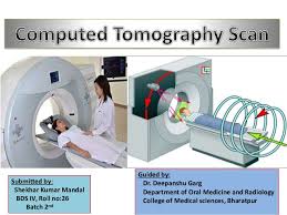 Ct Scan Final 2