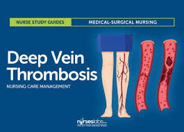 Deep Vein Thrombosis Nursing Care Management And Study Guide